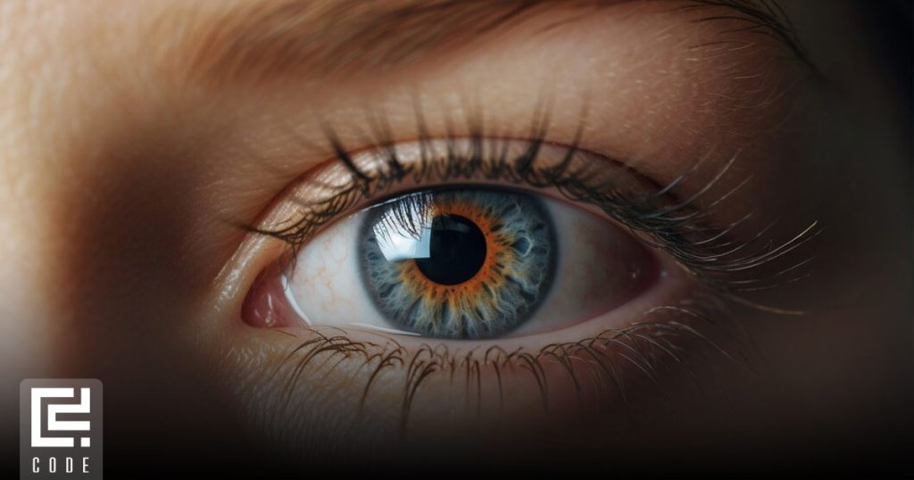 درمان پف زیر چشم