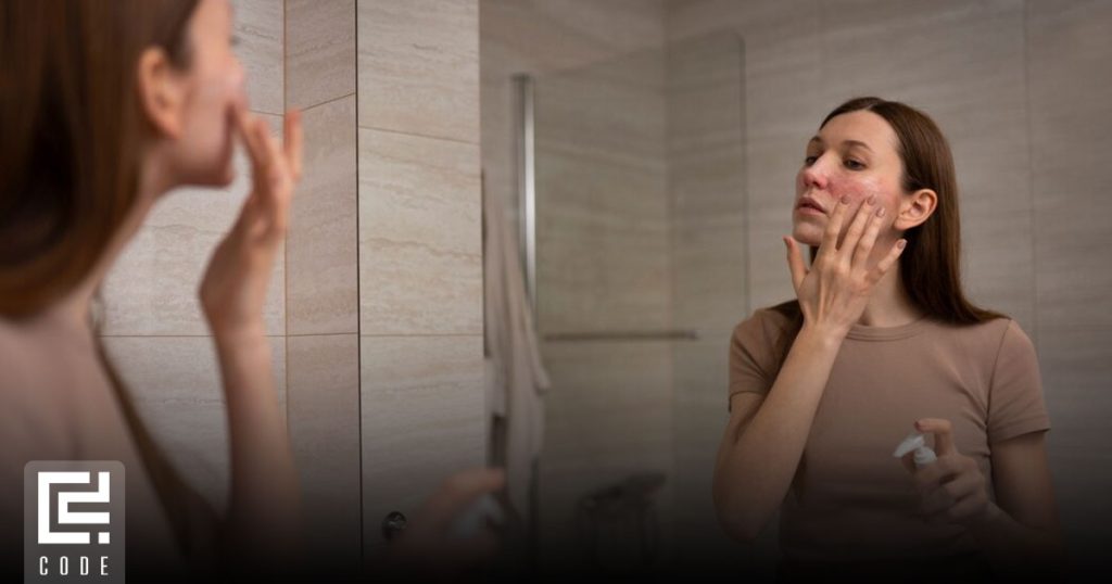 جوش زیر پوستی