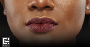 درمان فوری خشکی لب