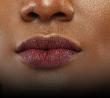 درمان فوری خشکی لب