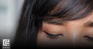 علت پوسته پوسته شدن ابرو