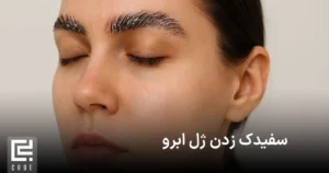 سفیدک زدن ژل ابرو
